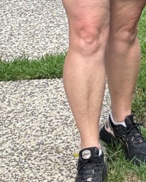 Shelly Horton Instagram - Darren forced me to take a stupid walk for my stupid mental health….

And THEN I saw that even the baby faces in my knees looked sad. 

Freaky baby faces 😳👶 probably didn’t like that we were couple dressing 👯