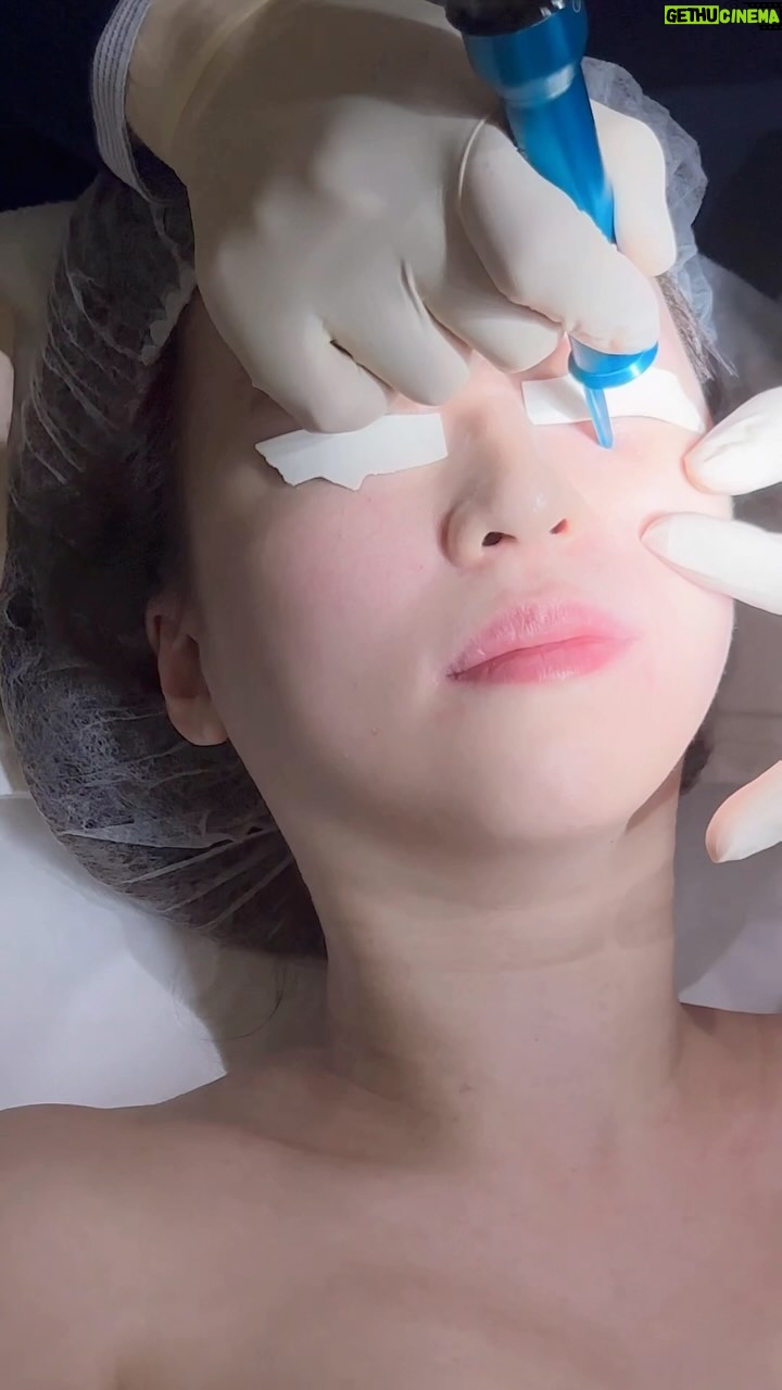 Snow Suen Instagram - 大家對我做脫疣療程嘅反應太熱烈, 所以尋日去做,今日即刻出片分享! 我係喺 @heal.aesthetic度脫疣! 為咗唔想越生越多,同埋驚傳染小朋友,我做足功課,揀咗呢一間,佢哋一間診所嚟㗎,我係搵醫生幫我做! 而且脫疣係醫保受保範圍嘅項目,所以有需要,可以請佢哋幫你寫Pre approval㗎!佢嘅用嘅儀器係脫疣co2 laser lumenis acupulse,更係被譽為” 愛馬仕界co2”, 創傷性比一般co2 laser低 ,復原期更快! 幫大家爭取左優惠, 話阿雪介紹就可以, 面/頸$7,500 (原價 9,000); 面+頸$15,000 (原價:$18,000) 仲可以有一次補脫! 想再知多啲可以直接DM/whatsapp 67494198🫶🏻 WhatsApp link: https://api.whatsapp.com/send/?phone=85267494198