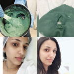 Thivya Naidu Instagram - Thank you doctor @ceciveron83 for the excellent care and concern on my skin ..ur amazing as always! Due to shoot and heavy makeups monthly treatments and facial is a must! Yes pamper ur skin more 😍 This time 😍 IVdrips+ prp facial + Casmara mask Iv drips 👉🏻boost ur energy level n glow Prp 👉🏻stimulates collagen production as well as decreases fine lines,acne scars and pores using ur own plasma! Casmara peel off mask 👉🏻favourite !help to rejuvenate and hydrate ur skin! Love how my skin feels now!thank you ! And don’t forget you have to also take care of ur skin too! Healthy food !drink plenty of water! Hydrate ur skin well ! @theklskyclinic #theskyclinic #saygoodbyetotiredskin #pamperurskinmore
