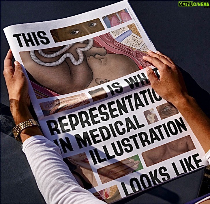 Tonya Lewis Lee Instagram - With less than 5% of medical images depicting dark skin, an illustration of a Black fetus in-womb sparked a global conversation about representation in medical imagery. In collaboration w/ @ebereillustrate, @jnj @deloittedigital created #IllustrateChange, a digital library of diverse and representative medical illustrations that builds momentum around representation in medical illustration and reduces disparities in health outcomes. ✍🏽✅ 🩺 Share widely‼️ Link in bio #RepresentationMatters #MedicalIllustration #DiversityInHealthcare #IllustrateChange #HealthEquity #MedicalImagery #InclusiveHealthcare #RacialHealthDisparities #IllustrateDiversity #HealthcareEquality