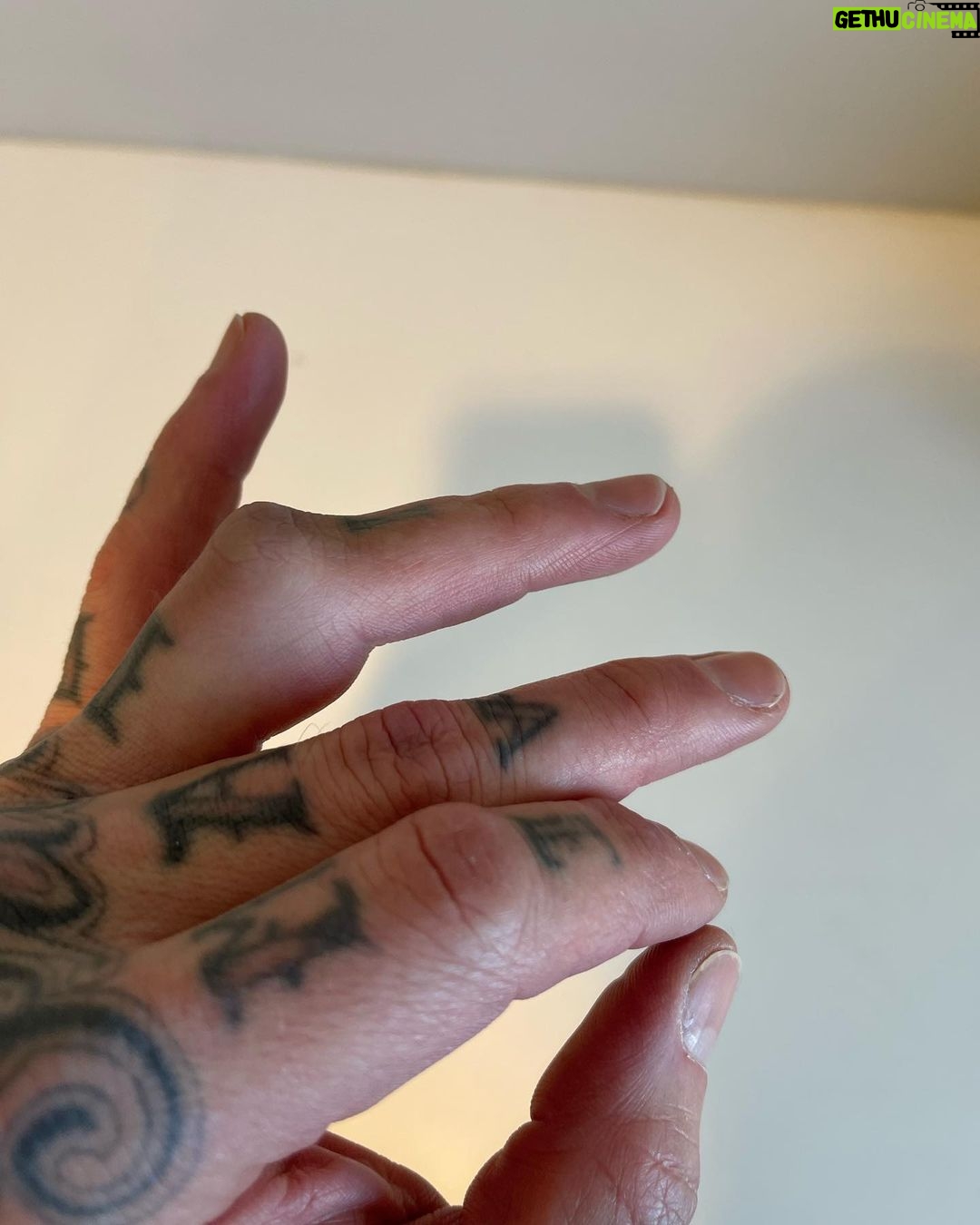 Travis Barker Instagram - Surgery tomorrow 🤞
