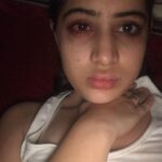 Urfi Javed Instagram – Just clarifying to these pictures are from 2016-2017 , not current 

Sharing with you all my lip filler journey 
I’ve been getting lip fillers from the age of 18 , I didn’t have that much money back then but I always felt my lips were too thin and I wanted bigger fuller lips . I went to dermat deni we’re ready to do it for less and these were the results at times ! I had to get them dissolved and mind it it’s the most painful thing ever !! I’m not telling people to not get them but Infact what I’m trying to say is just be careful while getting fillers or Botox . I still very much have lip fillers just that I know what suits my face and I know now less is more .  Encouraging everyone to throughly research before going to any doctor .  I actually revvokend fillers to everyone , if you have some insecurities about your face or body instead of hating yourself or your face it’s just better to opt for fillers or surgeries but but but from a very good doctor only.