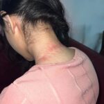 Urfi Javed Instagram - Throwback !! Swipe right to see the after effects 🥹😅