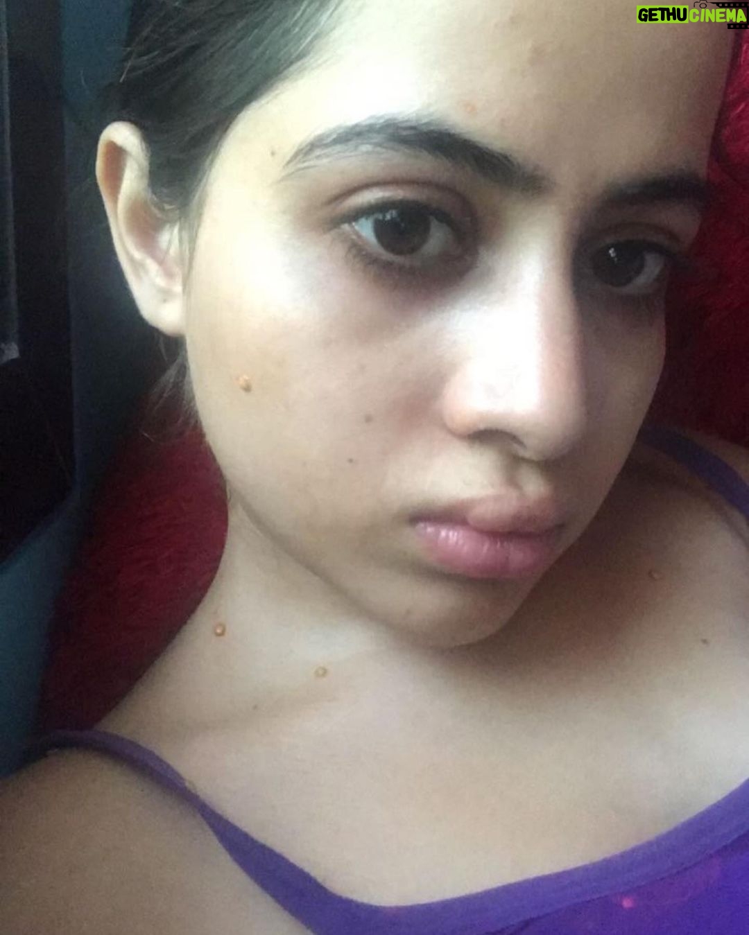 Urfi Javed Instagram - Just clarifying to these pictures are from 2016-2017 , not current Sharing with you all my lip filler journey I’ve been getting lip fillers from the age of 18 , I didn’t have that much money back then but I always felt my lips were too thin and I wanted bigger fuller lips . I went to dermat deni we’re ready to do it for less and these were the results at times ! I had to get them dissolved and mind it it’s the most painful thing ever !! I’m not telling people to not get them but Infact what I’m trying to say is just be careful while getting fillers or Botox . I still very much have lip fillers just that I know what suits my face and I know now less is more . Encouraging everyone to throughly research before going to any doctor . I actually revvokend fillers to everyone , if you have some insecurities about your face or body instead of hating yourself or your face it’s just better to opt for fillers or surgeries but but but from a very good doctor only.