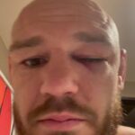 Viacheslav Borshchev Instagram - Because of eye poke I went to the hospital and have missed post fight interview, and I did not have the opportunity to thank all those involved, or at least the most involved. My wife @borshcheva__m , i don’t remember if I ever had such a strong support from you and now I know, together, we can reach any goals we want. My team @teamalphamalemma ( @kickboxingvlg )main couches @urijahfaber , @joey_rodriguez916 , @lastcall155 , @mvmnt_darren . extra thank to @urijahfaber for opening so many doors for me. Thank you @seaneaddy for giving me a hand in such a tough life moment. Thank @ufcpi for helping me prepare so well, probably better then ever. @the_massage_messiah @getmegoings your massage was big part my last camp thank you I felt amazing during the fight Thank Violetta Mordukhay the best lawyer in the game, she gave me big relief in right time. And of course thank @ufc , @seanshelby and @danawhite personally for giving me opportunity to show my skills and let people enjoy pure violence. #viacheslav_borshchev #slava_claus #teamalphamale #sacramento #volgograd #mma #ufc #fight UFC APEX