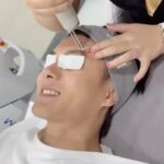 Worrachai Sirikongsuwan Instagram - คือ อยากหน้าเนียนๆ แล้วก็ใสๆมะ ทักมา!!! #SkinMaster #MasterpieceHospital #โรงพยาบาลมาสเตอร์พีซ #picobright @mtphospital @dr.saemaster @ll_dowmaster @dow_lapasrada @skinmasterbymtp