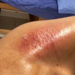 Ahmed Salah ElSaadany Instagram – اول ما ابتديت اسخن و ارجع للچيم كتفي و رقبتي قعدوني في البيت بروح اعمل جلسات علاج طبيعي و اول ما اخف ان شاء الله ححاول انزل تاني اتمرن لان الرياضه بتفرق كتير في النفسيه هي دي باختصار الحياه 
Ups and downs 🤷🏻‍♂️