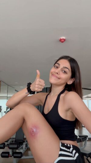 Alaya F Instagram - #StoryTime : The time I got bit by a spider🫠 Put your hand up 🙋🏻‍♀️