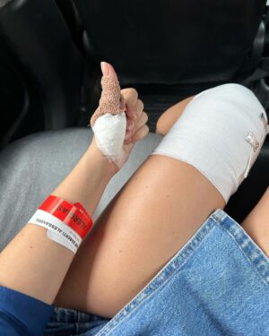 Alessandra Fuller Instagram - Abrazaré mis cicatrices para recordarme que esta batalla aún no termina, para recordar ese compromiso y entrega que tanto me moviliza. Y es que no hay nada más valioso e importante que intentarlo hasta el final. Gracias por tanto cariño y por esas hermosas palabras que me empujan a seguir adelante. Vamos por esa olla de oro 🥹❤️‍🩹