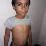 Amir Jafari Instagram - هادی ۸ساله هديه خداوند به پدر ومادرش بعد از بیست سال ، ساکن یکی از محرومترین روستاهای سیستان و بلوچستان،از بدو تولد دچار عارضه قلبی بوده و طبق تشخیص قلب این کودک سوراخ و مشکل ریوی دارد .سه بار مورد عمل قلب باز قرار گرفته در زاهدان،تهران و یزد .پدرش کارگری پا به سن است و مخارج سنگین عمل از عهده این خانواده خارج است ،لذا از شما هموطنان گرامی تقاضا میشود این کودک را یاری کنید.6037997155013106 بنام محمد بخش دهانی پدر کودک