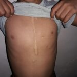 Amir Jafari Instagram - هادی ۸ساله هديه خداوند به پدر ومادرش بعد از بیست سال ، ساکن یکی از محرومترین روستاهای سیستان و بلوچستان،از بدو تولد دچار عارضه قلبی بوده و طبق تشخیص قلب این کودک سوراخ و مشکل ریوی دارد .سه بار مورد عمل قلب باز قرار گرفته در زاهدان،تهران و یزد .پدرش کارگری پا به سن است و مخارج سنگین عمل از عهده این خانواده خارج است ،لذا از شما هموطنان گرامی تقاضا میشود این کودک را یاری کنید.6037997155013106 بنام محمد بخش دهانی پدر کودک