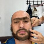 Artem Karokozyan Instagram - Он делает губы и груди как для себя! «Доктор Свисток» - первая российская пранк комедия. Во всех кинотеатрах с 17 февраля 2022. Главная экспериментальная Комедия следующей зимы. Во всех сценах фильма участвовали люди, которые не догадывались, что их снимают. Для съёмок мы сделали в Сочи почти настоящую клинику пластической хирургии.