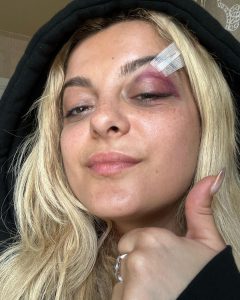 Bebe Rexha Instagram - Im good.