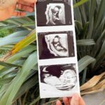 Benjamin Samat Instagram - BABY SAMAT is Coming ❤️🤰🏼 Nous sommes heureux de vous annoncer que nous serons bientot 3 🥺👶🏻 Nos Rêves se realisent un peu plus chaque jour… Je T’aime plus que tout et j’ai tellement hâte qu’on devienne futur Papa & Maman 🥰 #babyiscoming #pregnant #14sa