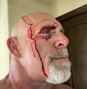 Bill Goldberg Instagram - #tpost 1 , Goldberg 0  #happytuesday  #aintgottimetobleed #lifeonthefarm #clutz #tractor #shootingrange #mishap #gotcolor #hardway #wrestling #oldschool #fleshwound #hardhead #spear #jackhammer #whosnext #superglue #texas 😏 #tisbutafleshwound