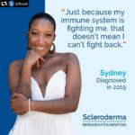 Bob Saget Instagram - Sydney is such an amazing woman. So proud I’m a Board Member of the Scleroderma Research Foundation to be with her as she “Fights Back” against this often debilitating disease. repost @srfcure ・・・ February is Black History Month, and Sydney @sydneysnoble is spreading awareness about how scleroderma affected her. "I find it extremely important to share my story this month,“ she says, because of the “lack of awareness about scleroderma plus the higher incidence of this disease within the Black community.” Like many patients, Sydney made difficult changes to her life when she was diagnosed a little over a year ago. “Prior to being diagnosed I was a professional dancer, photographer, and full-time business owner who juggled all three hustles simultaneously,” she says. Amidst the loss of these important parts of her life, Sydney’s grateful that she was able to be diagnosed quickly, but she realizes that’s not always true for others. "Scleroderma compared to other autoimmune diseases is so unknown within the nation today,” Sydney explains. It’s about more than just awareness for Sydney - she notes that research is critical. “Finding a cure is of the utmost importance,” she says, but also “finding treatment plans in the immediate future that are as safe and healthy for the body as possible.” In the meantime, Sydney’s positive mindset has kept her strong in the face of these challenges. “Although my life path has been forever changed I was able to adapt and continue on with running my candle business, The Noble Brand,” she says. “Just because my immune system is fighting me, that doesn't mean I can't fight back." #BlackHistoryMonth #TheNobleBrand #sclerodermaresearch #srfcure #sclerodermaresearchfoundation #scleroderma #morethanscleroderma #sclerodermafreeworld #research #raredisease #autoimmune #ResearchistheKey