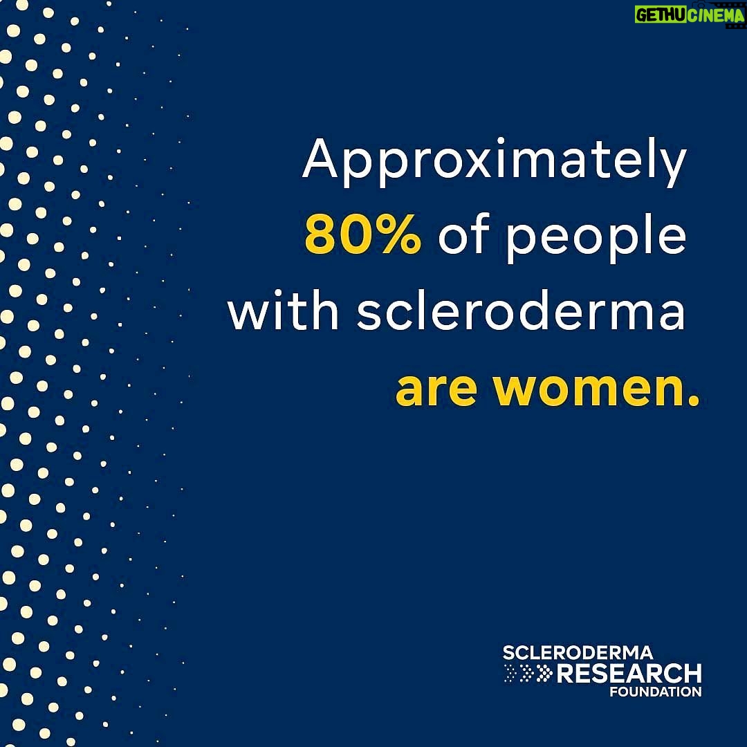 Bob Saget Instagram - I lost my sister to scleroderma years ago because the science wasn’t there -and the doctors she went to did not understand the disease. Thanks to the work of the Scleroderma RESEARCH Foundation and the Centers of Excellence we have always funded, we are moving the needle and working toward the cure. I am proud to be a board member of this amazing organization that has always been the largest organization in the world, donating the more money than any other organization focused on funding RESEARCH. Our big fundraiser, #CoolComedyHotCuisine happens again virtually - Sunday, October 17, 2021, at 5pm Pacific/8pm Eastern, LIVE on YouTube. Fellow Board Member @susanfeniger and I will once again be hosting. Go to SRFcure.org to register now for this great event featuring the best comedians and musicians -who donate their time to help us reach our goal. Thank you. repost @srfcure ・・・ Scleroderma is relatively rare; an estimated 300,000 Americans have scleroderma. Anyone can get this disease, including men and children, but approximately 80% of people with scleroderma are women. Scleroderma is a heterogeneous disease, meaning not everyone has the same experience. The way in which scleroderma progresses and changes over time varies greatly from person to person.  This is what makes a concise definition of scleroderma —and its diagnosis—difficult.   Please share so that more people will know what this disease is and does. Learn more about scleroderma and what researchers are doing to find improved treatments and, ultimately, a cure at srfcure.org or the link in our bio.