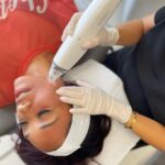 Candice Patton Instagram - Super happy to be back in LA! It’s been tooo long @drghavami ! Was so happy to get in and try the Potenza laser (Radio frequency + micro needling) to rejuvenate my skin, boost my collagen, target my dark spots and tighten the skin! Just the TLC my skin needed after a long shooting season! 😘 I was red for the rest of the day but fairly painless tbh! 🍅😌 Beverly Hills, California