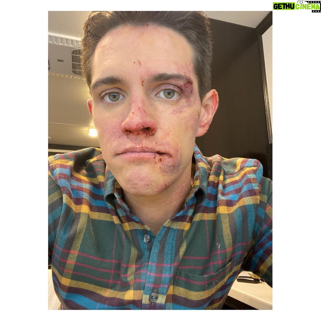 Casey Cott - 451K Likes - The day we shot this I FaceTimed my mom and told her I had fallen down a flight of stairs and she totally bought it.