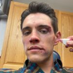 Casey Cott Instagram – The day we shot this I FaceTimed my mom and told her I had fallen down a flight of stairs and she totally bought it.