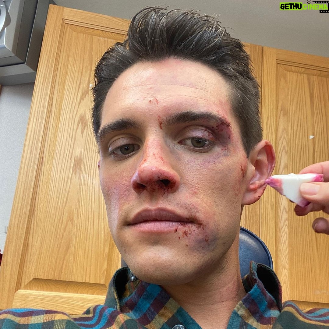 Casey Cott - 451K Likes - The day we shot this I FaceTimed my mom and told her I had fallen down a flight of stairs and she totally bought it.