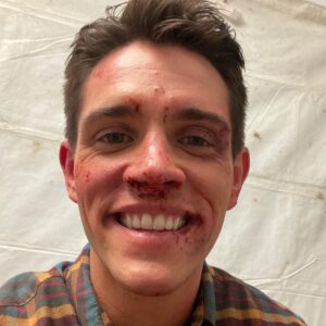 Casey Cott Instagram - The day we shot this I FaceTimed my mom and told her I had fallen down a flight of stairs and she totally bought it.