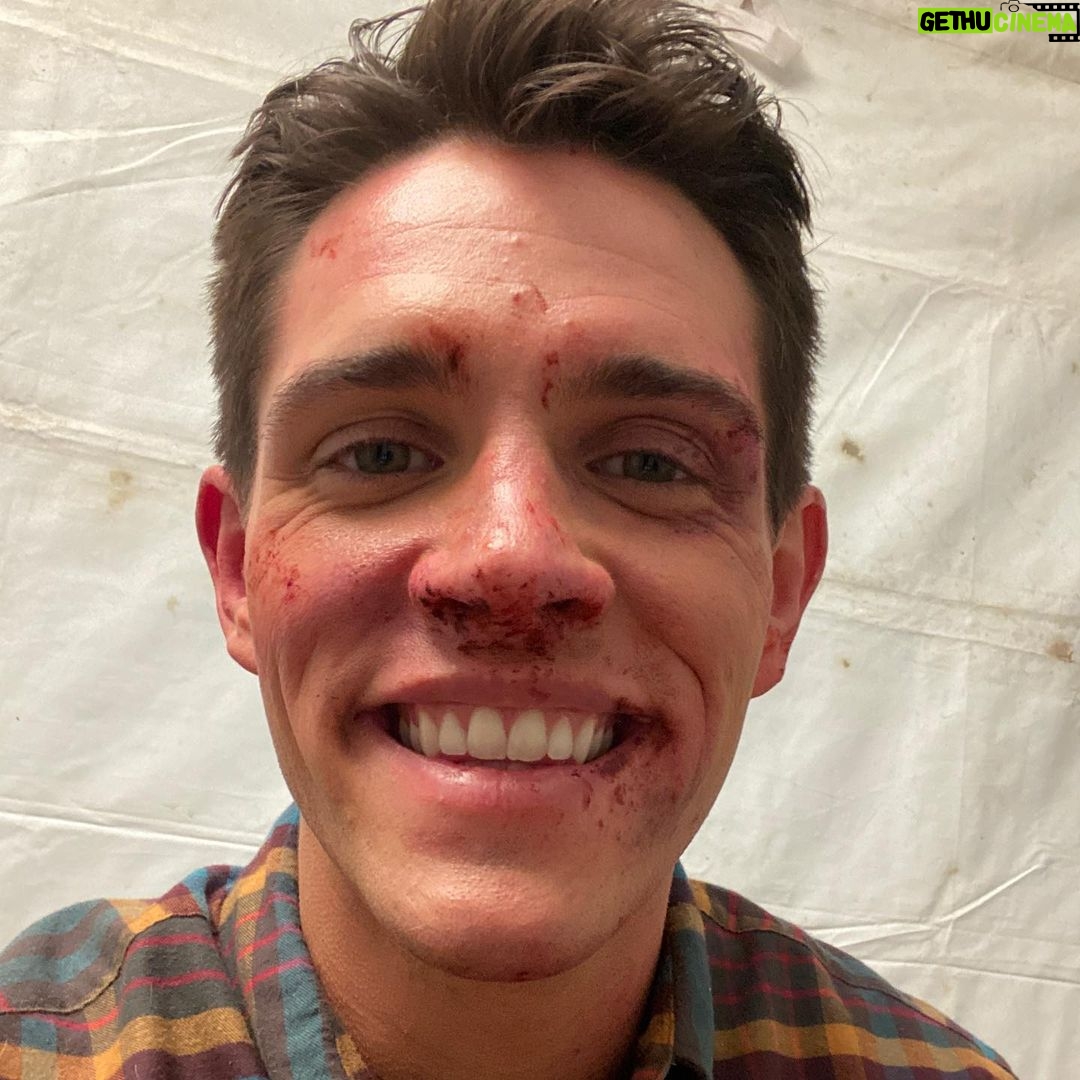 Casey Cott - 451K Likes - The day we shot this I FaceTimed my mom and told her I had fallen down a flight of stairs and she totally bought it.
