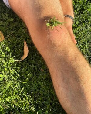 Casey Frey Instagram - I’m partnering with @dollarshaveclub as part of their #MenGetReal campaign. Dollar Shave Club’s got all your grooming needs covered, now at a store near you. #ad #dollarshaveclub.

Tarantula, twiggums, chicken leg, skinny dumbass. These are just some of the names I’ve been called throughout the years. All made me who I am....daddy. I broke both my legs when I was a kid. Had to relearn to walk and they still figured out a way to moonwalk there way into making a living. So in short I’m able to buy a big ass TV and pay for a roof over my head because of these scrawny little fuckers. 
Mark my words. Before I die, skinny hairy legs will be as revered as having a phat ass in today’s culture!