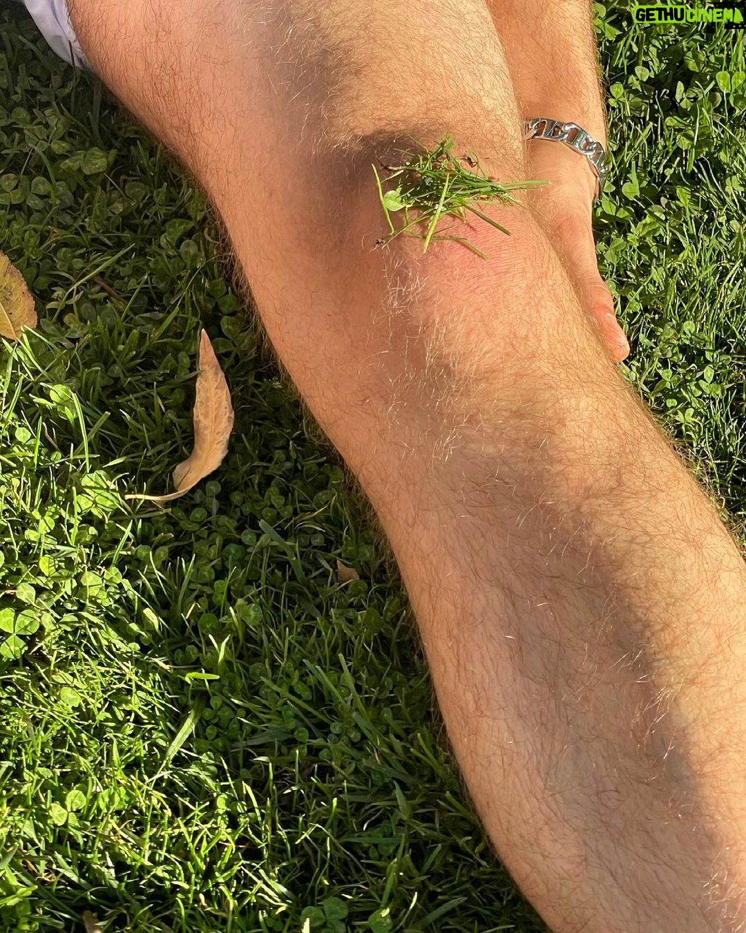 Casey Frey - 290.7K Likes - I’m partnering with @dollarshaveclub as part of their #MenGetReal campaign. Dollar Shave Club’s got all your grooming needs covered, now at a store near you. #ad #dollarshaveclub.
Tarantula, twiggums, chicken leg, skinny dumbass. These are just some of the names I’ve been called throughout the years. All made me who I am....daddy. I broke both my legs when I was a kid. Had to relearn to walk and they still figured out a way to moonwalk there way into making a living. So in short I’m able to buy a big ass TV and pay for a roof over my head because of these scrawny little fuckers.
Mark my words. Before I die, skinny hairy legs will be as revered as having a phat ass in today’s culture!