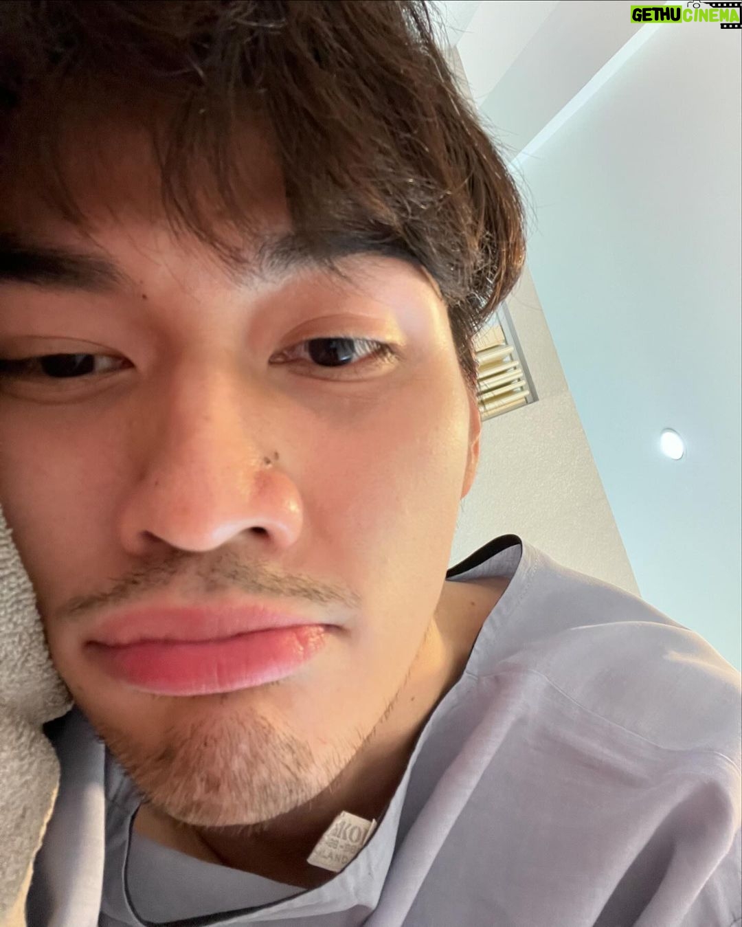 Chinnarat Siriphongchawalit Instagram - จะหายได้ยัง