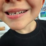Christian Figueiredo Instagram - resumo do fds em família 🥰 1) gael quebrou o dente (de novo) 😮‍💨 2) a foto que mandei pro @paulobonavides na hora do inusitado acontecimento! 😂 3) o @gael aprendeu uma lição esse fds 🤪 4) levamos o nikki na obra da casa nova (ele falando “casa nova” 🥹) 5) spoiler da nossa suíte 70% 😎 6) nikki amando espinafre é tudo pra mim! 🤣 7) o gael falou: “papai, olha aqui! eu sou o zé meleca” (tive que bater uma foto HAHAHAHAHA) 😅 8) nosso mini modelo já escolhe os próprios looks! 😍 9) minha mãe matando a saudade do neto 💛 10) meu pôr do sol é minha fonte de energia ☀️
