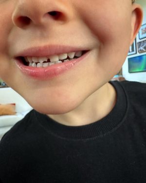 Christian Figueiredo Instagram - resumo do fds em família 🥰

1) gael quebrou o dente (de novo) 😮‍💨
2) a foto que mandei pro @paulobonavides
na hora do inusitado acontecimento! 😂
3) o @gael aprendeu uma lição esse fds 🤪
4) levamos o nikki na obra da casa nova
(ele falando “casa nova” 🥹)
5) spoiler da nossa suíte 70% 😎
6) nikki amando espinafre é tudo pra mim! 🤣
7) o gael falou: “papai, olha aqui! eu sou o zé meleca”
(tive que bater uma foto HAHAHAHAHA) 😅
8) nosso mini modelo já escolhe os próprios looks! 😍
9) minha mãe matando a saudade do neto 💛
10) meu pôr do sol é minha fonte de energia ☀️