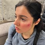 Divya Khosla Kumar Instagram - Got badly injured during an action sequence for my upcoming project. But the show must go on. Need all your blessings and healing energy 🙏🏻