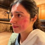 Divya Khosla Kumar Instagram - Got badly injured during an action sequence for my upcoming project. But the show must go on. Need all your blessings and healing energy 🙏🏻