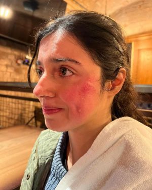 Divya Khosla Kumar Instagram - Got badly injured during an action sequence for my upcoming project. But the show must go on.
Need all your blessings and healing energy 🙏🏻