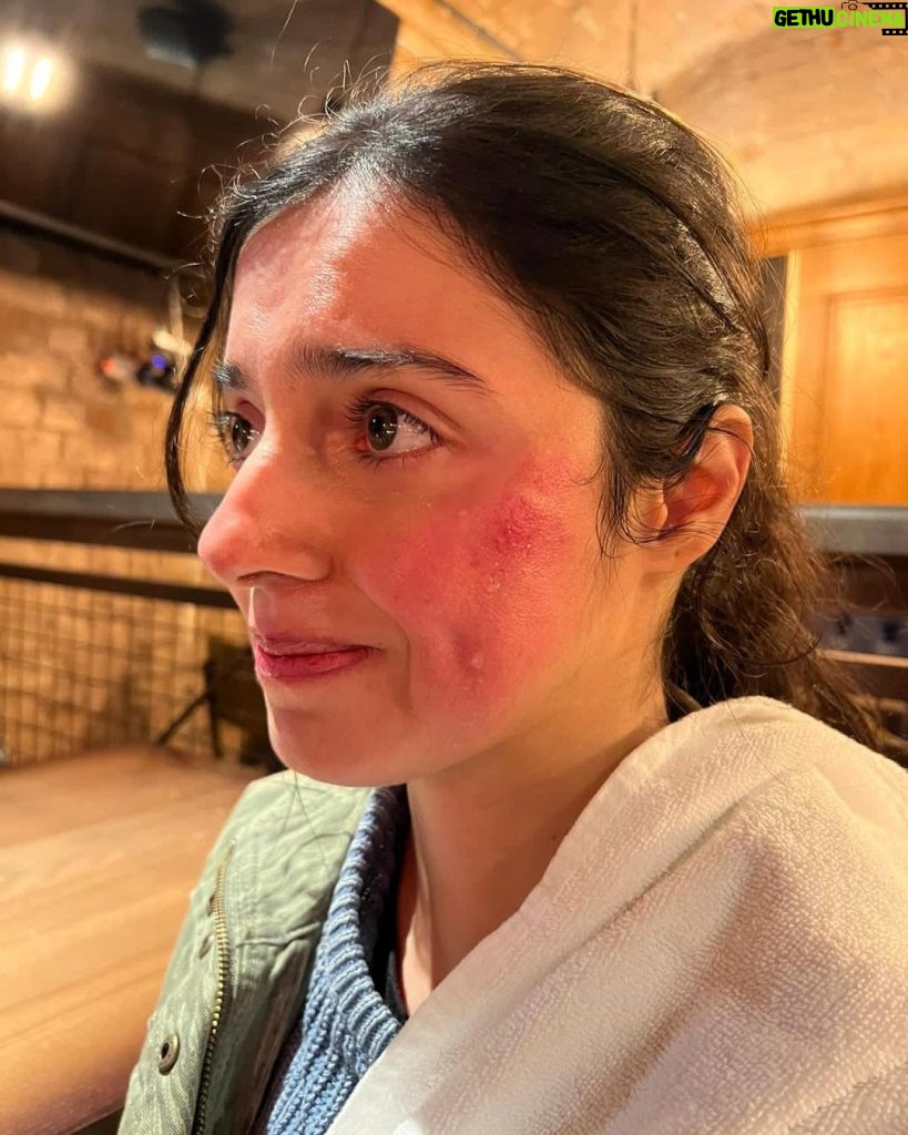 Divya Khosla Kumar Instagram - Got badly injured during an action sequence for my upcoming project. But the show must go on. Need all your blessings and healing energy 🙏🏻