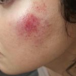 Divya Khosla Kumar Instagram - Got badly injured during an action sequence for my upcoming project. But the show must go on. Need all your blessings and healing energy 🙏🏻