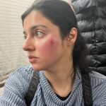 Divya Khosla Kumar Instagram - Got badly injured during an action sequence for my upcoming project. But the show must go on. Need all your blessings and healing energy 🙏🏻