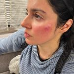 Divya Khosla Kumar Instagram - Got badly injured during an action sequence for my upcoming project. But the show must go on. Need all your blessings and healing energy 🙏🏻