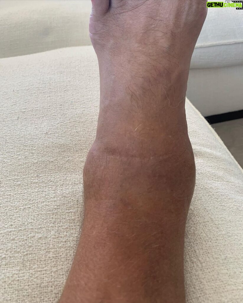 Dolph Lundgren Instagram - Finally doing surgery on my left ankle. I’ve had this injury since my time in the military. During 40 years of martial arts and doing action films, it’s been a fight every day. The joint is now basically destroyed. Directing and starring in Wanted Man really did it in…Can’t wait to be able to walk normally again. 🙏👌👊 Will keep you posted.
