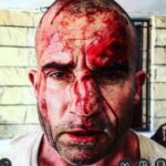 Dominic Purcell Instagram - Whilst filming #prisonbreak 5. An iron bar fell 10 feet splitting my skull and breaking/shattering my nose in 4 places.