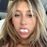 Elliana Walmsley Instagram - wisdom teeth = gone