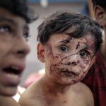 Essam Elsakka Instagram - 🇮🇱 Hi @Israel when will you STOP BOMBING CHILDREN IN GAZA? #gazaunderattack #gazapalestine #savegaza #israel #israelturismo #israelterrorist #israeltravel