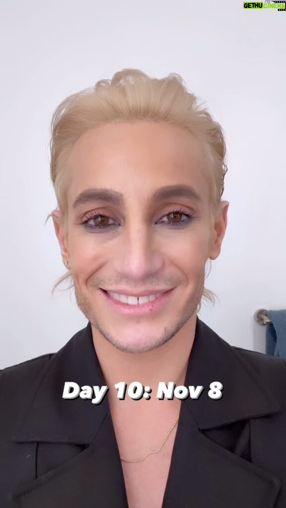 Frankie Grande Instagram - My 10-day @laseraway Botox journey 😘 How do I look?