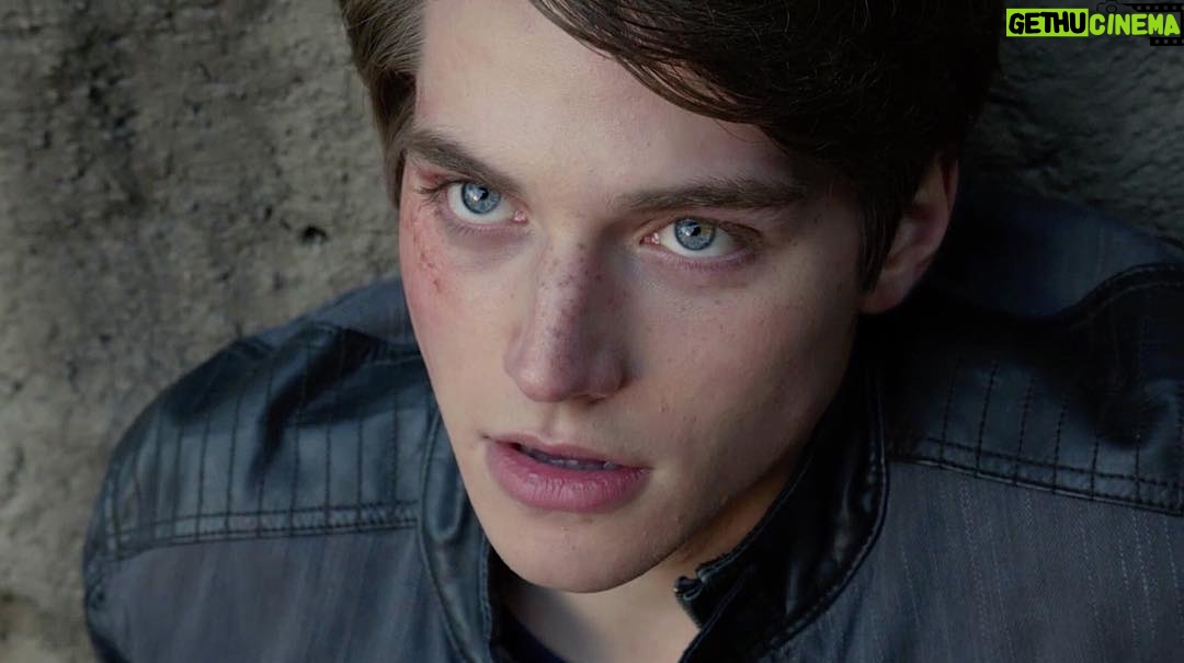 Froy Gutierrez Instagram - shoulda seen the other guy. wait - you can! tune in tomorrow on teen wolf :) ➖🤕➖