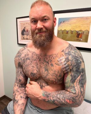 Hafþór Júlíus Björnsson Instagram - WARNING GRAPHIC SURGERY FOOTAGE. Live on my YouTube channel. Wednesday I’m 4 weeks post surgery. Sadly I got an infection 5 days ago resulting in an abscess and had to have a drainage tube inserted.  Finally had that removed today. Swipe to see the length of it! 🤯