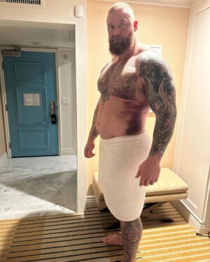 Hafþór Júlíus Björnsson Instagram - I know this looks bad, but I actually feel terrific. I am confident that the team around me will produce an optimal outcome for me. It may sound strange, but I actually can’t wait for the surgery tomorrow. 
PS I’m posting a new YouTube video of my recovery journey, at 9am PDT or 4pm GMT tomorrow