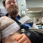 Hafþór Júlíus Björnsson Instagram – WARNING GRAPHIC SURGERY FOOTAGE. Live on my YouTube channel. Wednesday I’m 4 weeks post surgery. Sadly I got an infection 5 days ago resulting in an abscess and had to have a drainage tube inserted.  Finally had that removed today. Swipe to see the length of it! 🤯