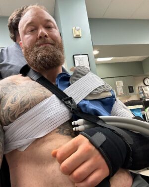 Hafþór Júlíus Björnsson Instagram - WARNING GRAPHIC SURGERY FOOTAGE. Live on my YouTube channel. Wednesday I’m 4 weeks post surgery. Sadly I got an infection 5 days ago resulting in an abscess and had to have a drainage tube inserted.  Finally had that removed today. Swipe to see the length of it! 🤯