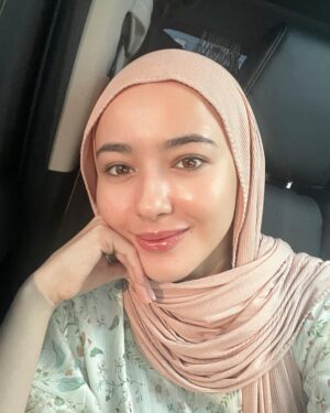 Hannah Delisha Instagram - smiles for miles🤍

did my raya skin treatment earlier😛 @my__clinic